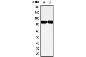 Western blot analysis of Cortactin (pY466) expression in HeLa UV-treated (A), NIH3T3 H2O2-treated (B) whole cell lysates. (Cortactin antibody  (C-Term, pTyr466))
