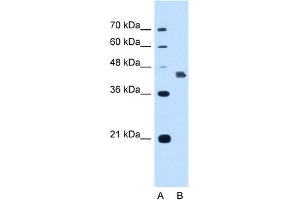 WB Suggested Anti-DFNA5 Antibody Titration:  1. (DFNA5 antibody  (C-Term))