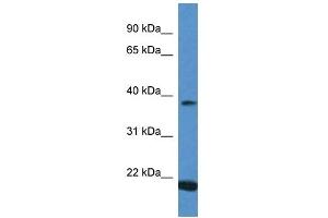 Western Blot showing IFNA13 antibody used at a concentration of 1 ug/ml against Placenta Lysate (IFNA13 antibody  (C-Term))