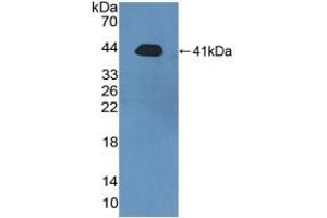 Detection of Recombinant PRH2, Human using Polyclonal Antibody to Acidic Salivary Proline Rich Phosphoprotein 2 (PRH2) (PRH2 antibody  (AA 17-166))