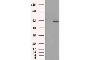 HEK293T cells were transfected with the pCMV6-ENTRY control (Left lane) or pCMV6-ENTRY PPP5C (Right lane) cDNA for 48 hrs and lysed. (PP5 antibody)