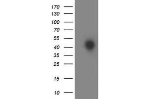 Western Blotting (WB) image for anti-Homeobox C11 (HOXC11) antibody (ABIN1498708) (HOXC11 antibody)
