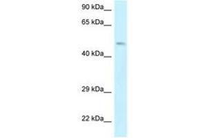 Image no. 1 for anti-erythrocyte Membrane Protein Band 4.9 (Dematin) (EPB49) (AA 142-191) antibody (ABIN6747541) (Dematin antibody  (AA 142-191))