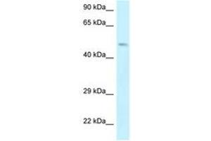 Image no. 1 for anti-erythrocyte Membrane Protein Band 4.9 (Dematin) (EPB49) (AA 142-191) antibody (ABIN6747541)
