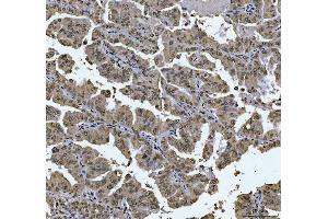 IHC analysis of AREB6/ZEB1 using anti-AREB6/ZEB1 antibody (ABIN7602990).