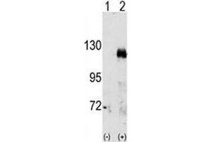 Western blot analysis of EphA3 antibody and 293 cell lysate either nontransfected (Lane 1) or transiently transfected with the EphA3 gene (2). (EPH Receptor A3 antibody  (AA 896-928))
