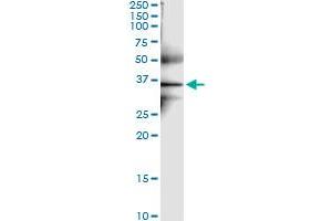 Immunoprecipitation of GPD1L transfected lysate using anti-GPD1L MaxPab rabbit polyclonal antibody and Protein A Magnetic Bead , and immunoblotted with GPD1L purified MaxPab mouse polyclonal antibody (B01P) . (GPD1L antibody  (AA 1-351))