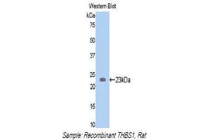 Western Blotting (WB) image for anti-Thrombospondin 1 (THBS1) (AA 71-259) antibody (ABIN1173304) (Thrombospondin 1 antibody  (AA 71-259))