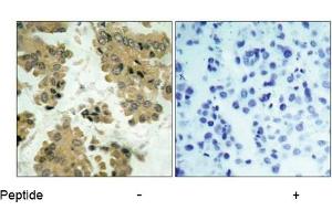 Image no. 1 for anti-V-Akt Murine Thymoma Viral Oncogene Homolog 2 (AKT2) (Ser474) antibody (ABIN197359) (AKT2 antibody  (Ser474))