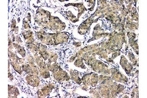 IHC analysis of EIF6 using anti-EIF6 antibody (ABIN6719594). (EIF6 antibody  (AA 66-210))