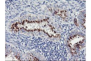 Image no. 6 for anti-Golgi Membrane Protein 1 (GOLM1) antibody (ABIN1498494) (GOLM1 antibody)