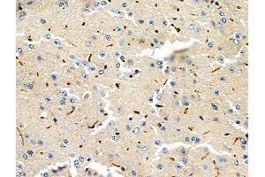 ABIN6264654 and ABIN6276603 at 1/100 staining Mouse brain tissue by IHC-P.