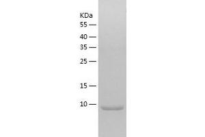 DYNLRB2 Protein (AA 1-96) (His tag)