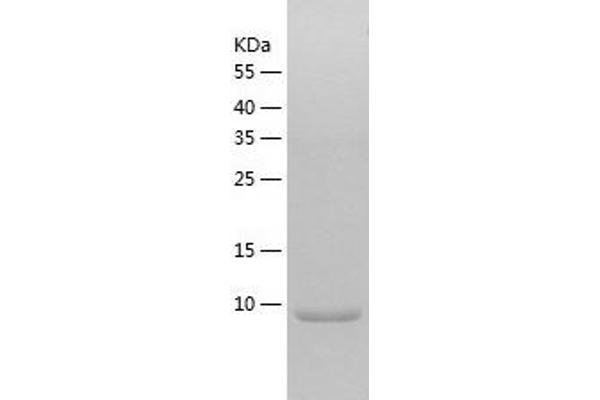 DYNLRB2 Protein (AA 1-96) (His tag)