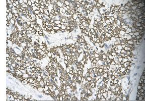 Immunohistochemistry (IHC) image for anti-Mortality Factor 4 Like 1 (MORF4L1) (Middle Region) antibody (ABIN2777616)