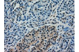 Immunohistochemical staining of paraffin-embedded pancreas tissue using anti-FERMT2mouse monoclonal antibody.
