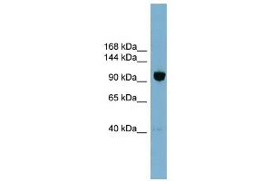 OSBPL8 antibody used at 1 ug/ml to detect target protein. (OSBPL8 antibody  (Middle Region))