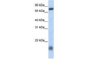 WB Suggested Anti-C21orf13 Antibody Titration:  0. (LCA5L antibody  (N-Term))
