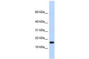 Image no. 1 for anti-Egl-9 Family Hypoxia Inducible Factor 2 (EGLN2) (AA 281-315) antibody (ABIN6740396) (PHD1 antibody  (AA 281-315))