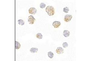 Immunocytochemistry of Slc35D1 in Daudi cells with this product at 5 μg/ml. (SLC35D1 antibody  (C-Term))