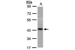 WB Image Sample(30 ug whole cell lysate) A:H1299 10% SDS PAGE antibody diluted at 1:1000 (ST3GAL2 antibody)