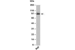 Western blot testing of human samples with TRIL antibody at 2ug/ml. (TRIL antibody  (C-Term))