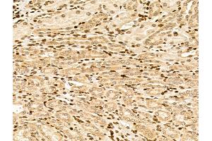 anti-Myosin IE (MYO1E) (C-Term) antibody