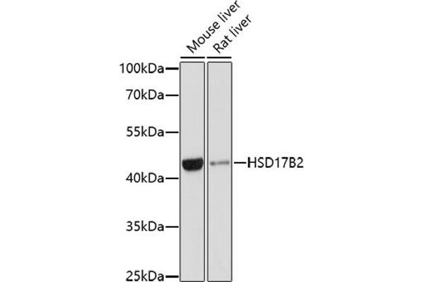 HSD17B2 antibody  (AA 118-387)