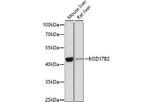 Western blot analysis of extracts of various cell lines, using HSD17B2 antibody (ABIN3015794, ABIN3015795, ABIN3015796 and ABIN6219142) at 1:1000 dilution.