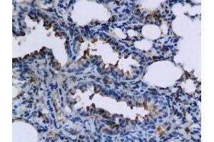 Formalin-fixed and paraffin embedded mouse lung labeled with Rabbit Anti-TNFSF15 Polyclonal Antibody, Unconjugated  followed by conjugation to the secondary antibody and DAB staining (TNFSF15 antibody  (AA 161-251))
