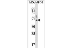Western blot analysis in MDA-MB435 cell line lysates (35ug/lane). (MMP16 antibody  (N-Term))