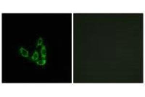 Immunofluorescence analysis of A549 cells, using GCNT3 antibody. (GCNT3 antibody)