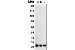 Western blot analysis of SOCS2 expression in K562 (A), A204 (B), PC12 (C) whole cell lysates. (SOCS2 antibody  (Center))