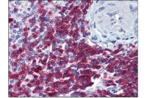 Immunohistochemistry (IHC) image for anti-CD247 Molecule (CD247) (AA 1-165) antibody (ABIN782349) (CD247 antibody  (AA 1-165))