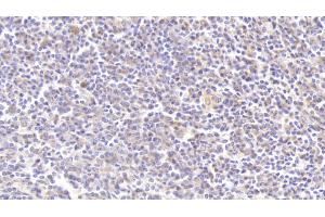 Detection of C3a in Human Spleen Tissue using Polyclonal Antibody to Complement Component 3a (C3a) (C3a antibody  (AA 672-748))