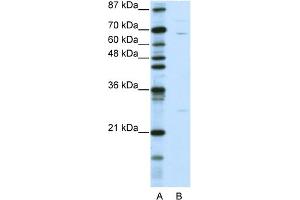 WB Suggested Anti-KLHL13 Antibody Titration:  0.