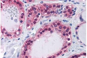 Human Thyroid: Formalin-Fixed, Paraffin-Embedded (FFPE) (SDSL antibody  (AA 1-330))