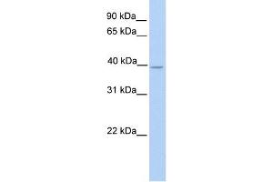 NEK6 antibody used at 1 ug/ml to detect target protein. (NEK6 antibody)