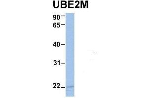 Host:  Rabbit  Target Name:  UBE2M  Sample Type:  Human MCF7  Antibody Dilution:  1.