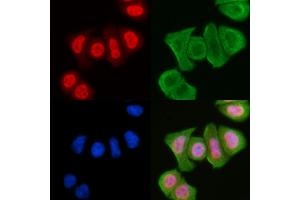 staining Hela cells(30 min of UV treatment) by IF/ICC. (MAPK8IP1 antibody  (pThr103))