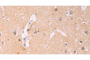 Immunohistochemistry of paraffin-embedded Human brain using ADCY1 Polyclonal Antibody at dilution of 1:60 (ADCY1 antibody)