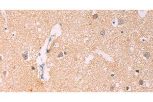 Immunohistochemistry of paraffin-embedded Human brain using ADCY1 Polyclonal Antibody at dilution of 1:60