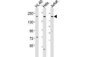 All lanes : Anti-DIP2A Antibody (Center) at 1:1000-1:2000 dilution Lane 1: HL-60 whole cell lysates Lane 2: Hela whole cell lysates Lane 3: Jurkat whole cell lysates Lysates/proteins at 20 μg per lane.