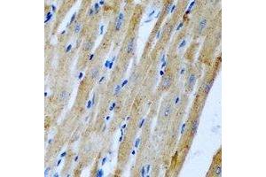 Immunohistochemical analysis of Fis1 staining in rat heart formalin fixed paraffin embedded tissue section. (Fission 1 antibody)