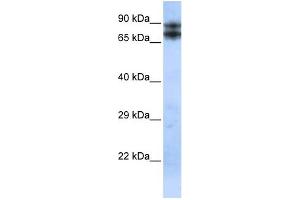WB Suggested Anti-LIMA1 Antibody Titration:  0. (LIMA1 antibody  (N-Term))