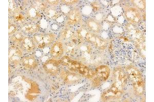 ABIN6256394 and ABIN6267617 at 1/100 staining human normal kidney tissue by IHC-P. (PKC delta antibody  (pSer645))