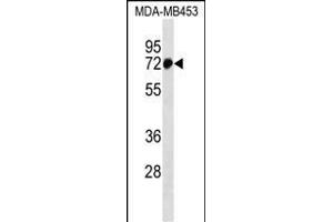 ZN Antibody (N-term) (ABIN1539007 and ABIN2838109) western blot analysis in MDA-M cell line lysates (35 μg/lane).
