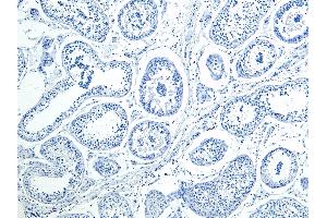 ABIN1590026 Negative Control showing staining of paraffin embedded Human Testis, with no primary antibody. (HOXA10 antibody  (Internal Region))