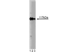 Western blot analysis of rabaptin-5 on a MCF-7 lysate. (RABEP1 antibody  (AA 247-417))