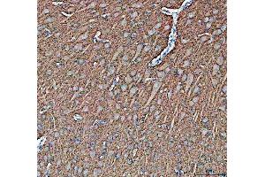 IHC analysis of Synapsin II using anti-Synapsin II antibody (ABIN4886735). (SYN2 antibody  (AA 497-582))